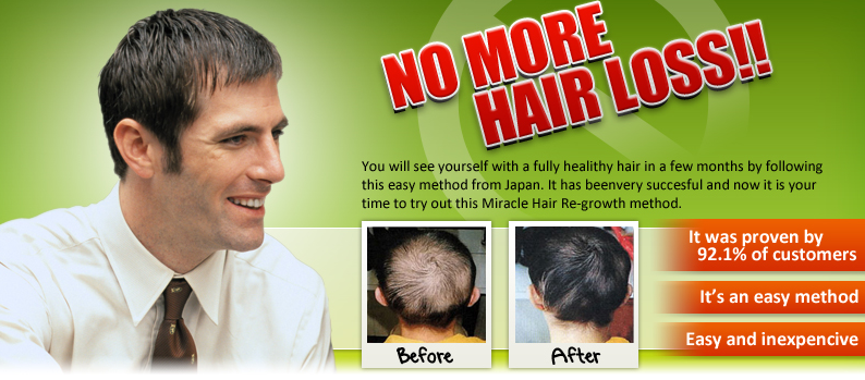 Hiroko Kobayashi – Japanese Miracle hair regrowth manual Do it Yourself 2 Min a Day