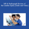 Dr. Jennifer J Pedley - MR & Radiograph Review of the Lumbar Spine