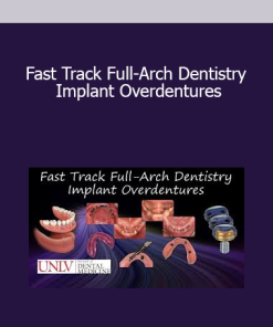 Fast Track Full-Arch Dentistry Implant Overdentures