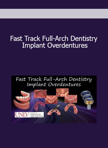 Fast Track Full-Arch Dentistry Implant Overdentures